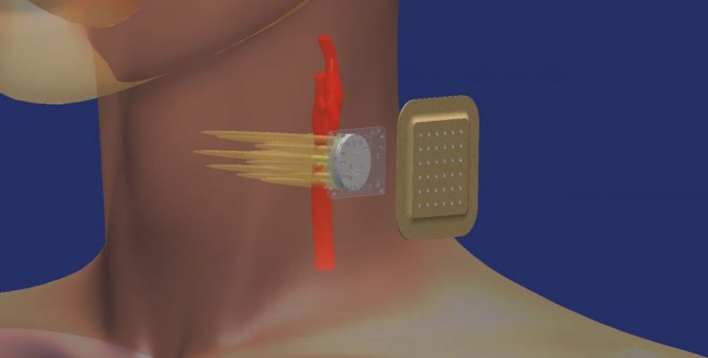 Compressive 3D Ultrasound Imaging Using a Single Sensor